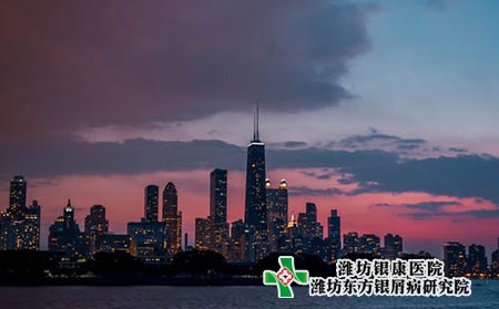牛皮癣和季节有关系吗?应该注意什么?