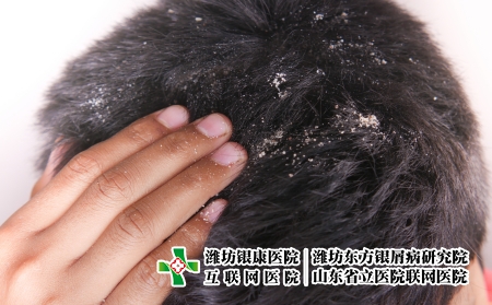 摄图网_330166077_头发上涂着脱衣男装的男子皮肤科真菌头皮医疗药品薄片皮肤洗发水卫生分泌（企业商用）