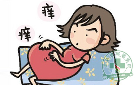 预防银屑病发生的措施有哪些