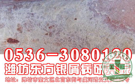 银屑病治疗期间应该怎样注意用药?