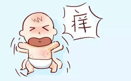 怎么治疗银屑病好