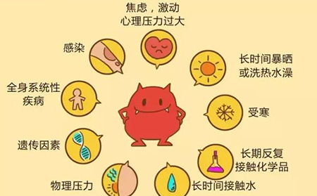 怎么预防银屑病