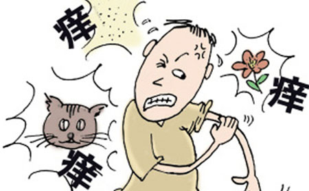 银屑病的症状有什么