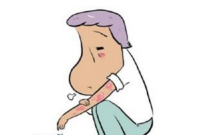 潍坊银屑病的症状有什么