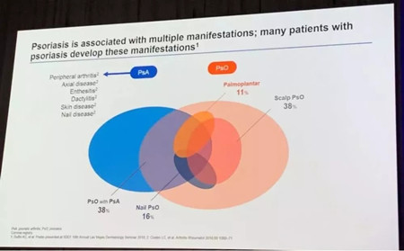 关节型银屑病诊治探索