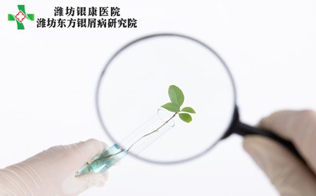 牛皮癣发病原因,脚上牛皮癣病因