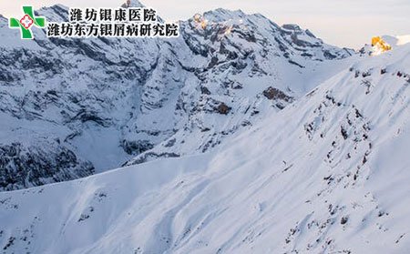 牛皮癣冬季保暖需要注意什么?